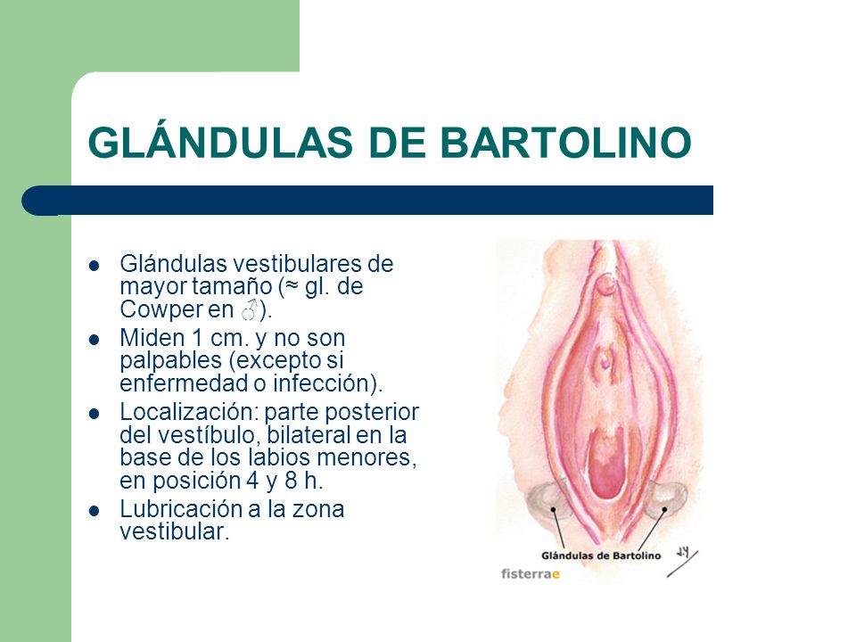 Quiste de bartolino y tratamiento